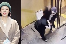 피습 후유증에 개두술 받은 배현진…